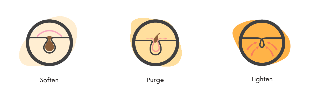 steps of removing blackhead