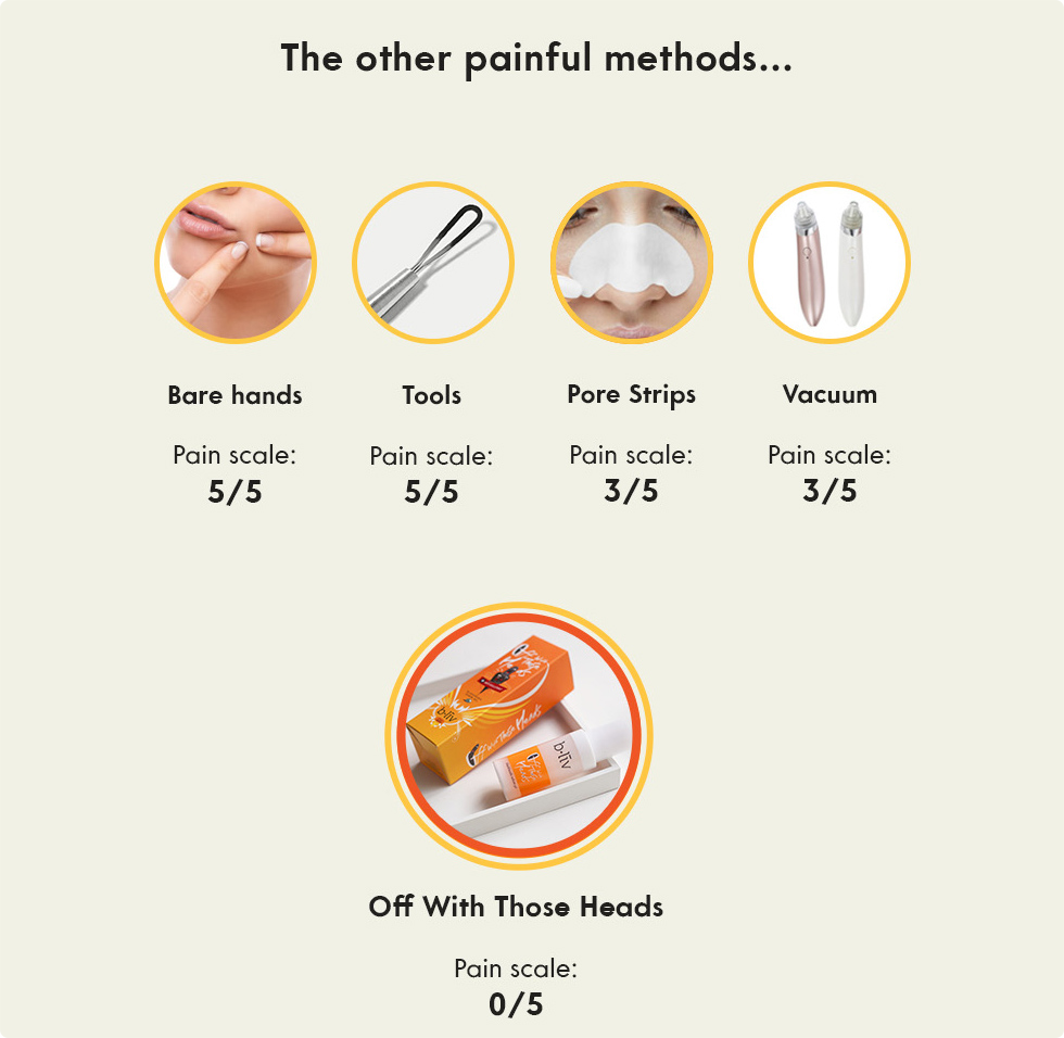 remove blackheads painlessly